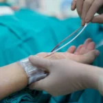 القسطرة التشخيصية