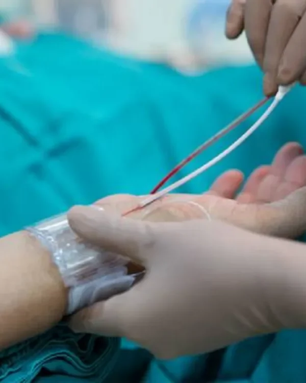 القسطرة التشخيصية