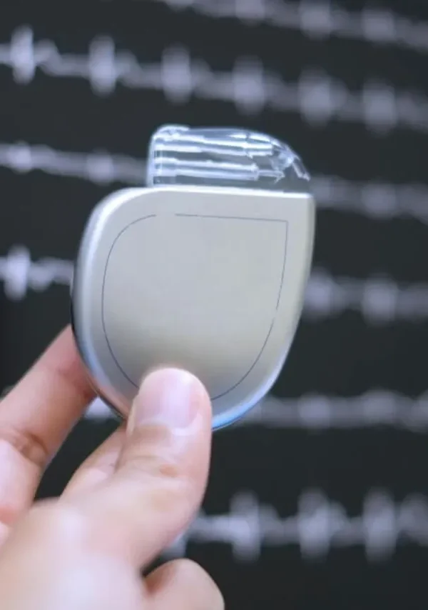 عملية زراعة جهاز تنظيم ضربات القلب