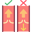 علاج الصمام الميترالي بالقسطرة
