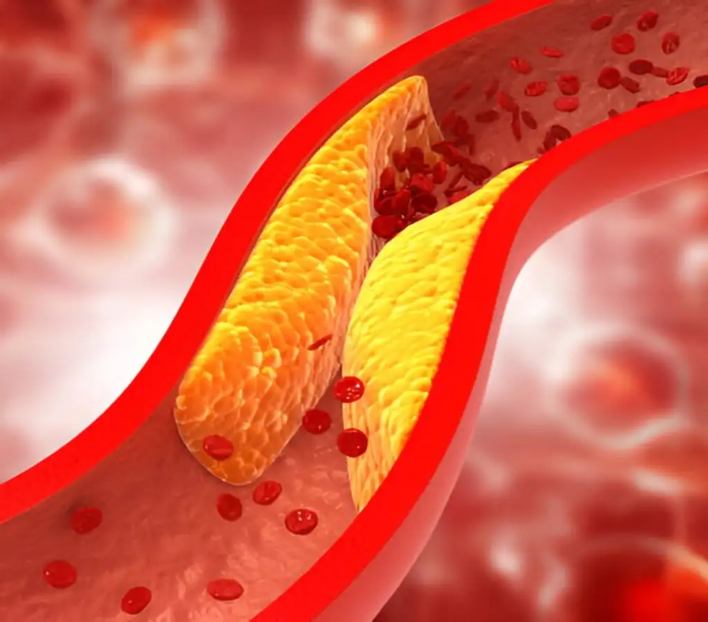 علاج أمراض القلب والأوعية الدموية