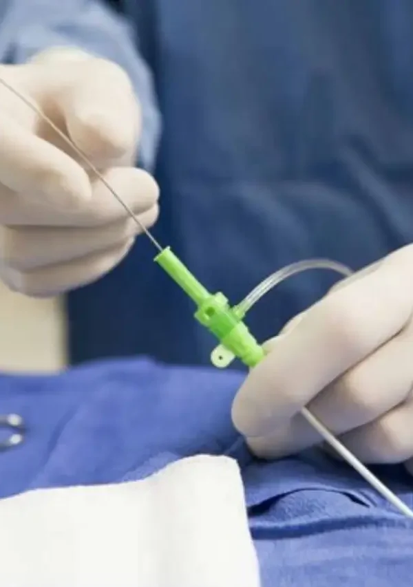 مدة عملية قسطرة القلب